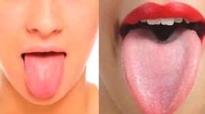 Tongue color