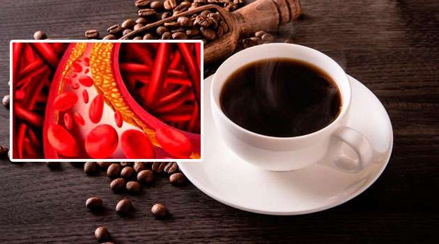 cholesterol coffee