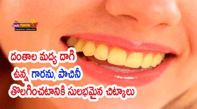 Remove Teeth Plaque