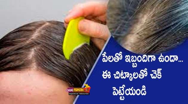 Lice Home remedies