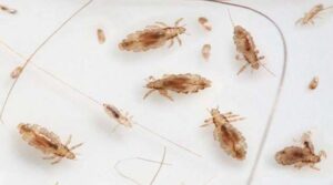 How to remove head lice In Telugu