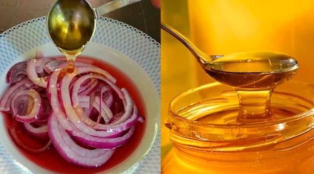 Benefits Of Honey And Onion Juice In Telugu