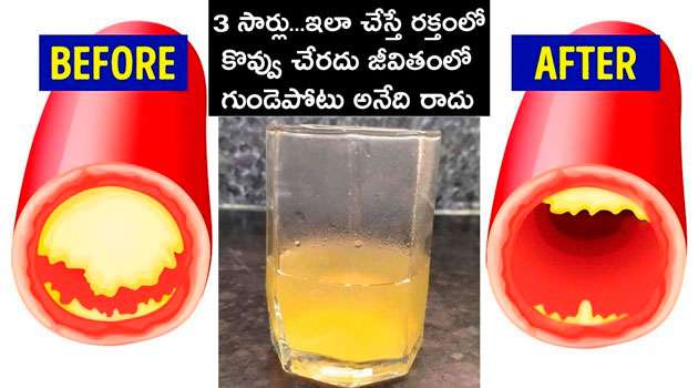 cholesterol reduce drink In Telugu