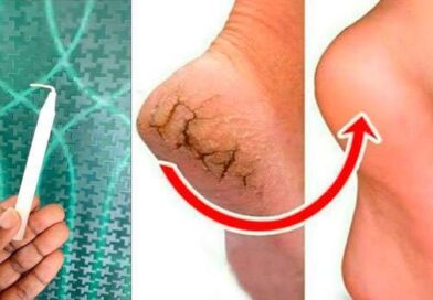 పాదాల పగుళ్లతో ఇబ్బంది పడుతున్నారా? ఇంట్లోనే ఈ ఒక్క చిట్కాతో పగుళ్లు మాయం!