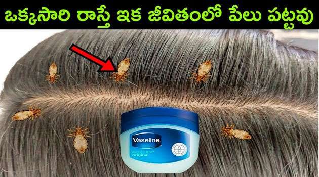 Hair lice remove tips In Telugu