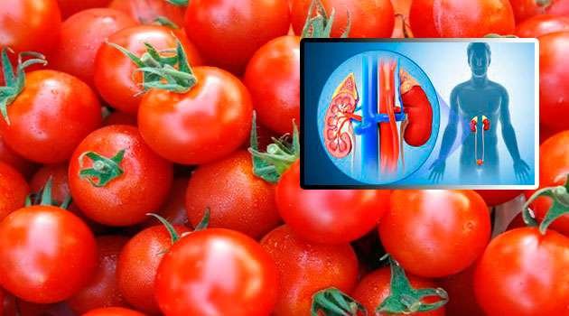 Tomatoes cause kidney stones In Telugu