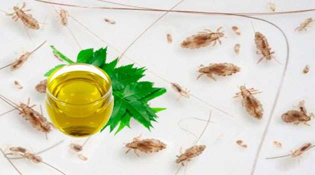 lice home remedies