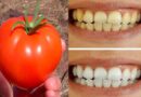 How to whiten teeth at home