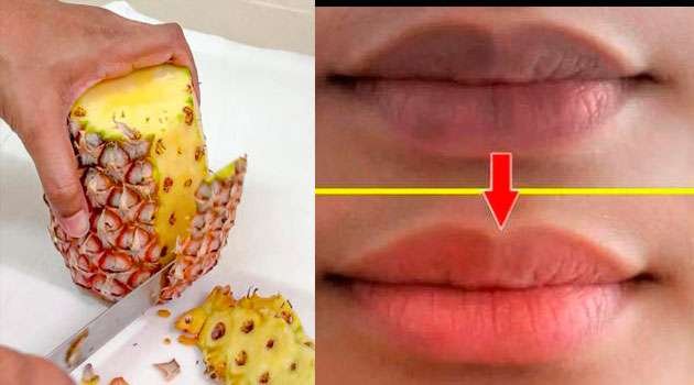 pineapple repairs your cracked lips