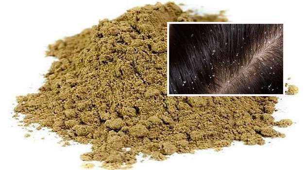 Dandruff Home Remedies In Telugu