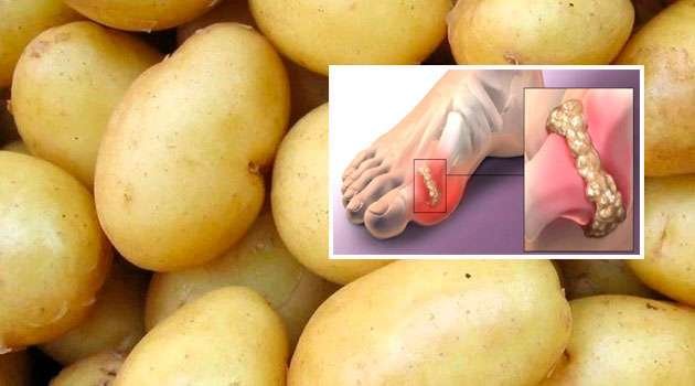 Uric acid potato