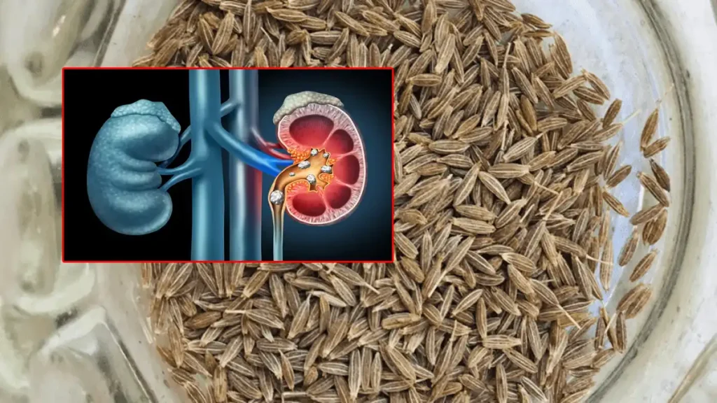 cumin seeds benefits