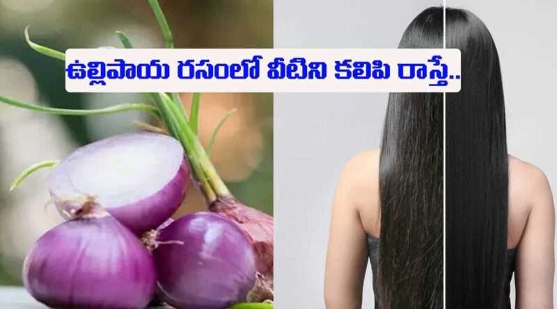 onion hair fall