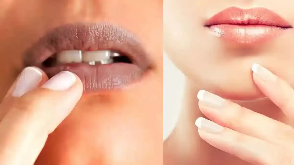 dark lips remedies