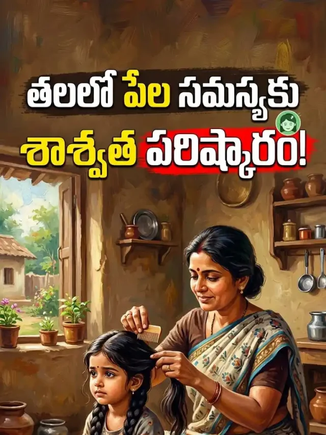 తలలో పేల సమస్యకు శాశ్వత పరిష్కారం! ఈ 5 ఇంటి చిట్కాలు ప్రయత్నించండి