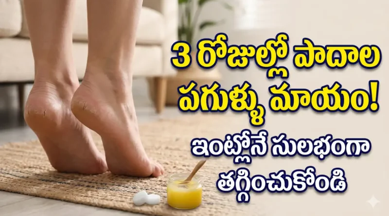 Cracked home remedies