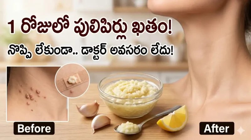 warts remove tips in telugu